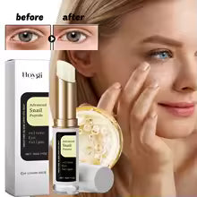 Eye Cream Remove Wrinkles Eliminate Eye Bags Dark Circles Eye